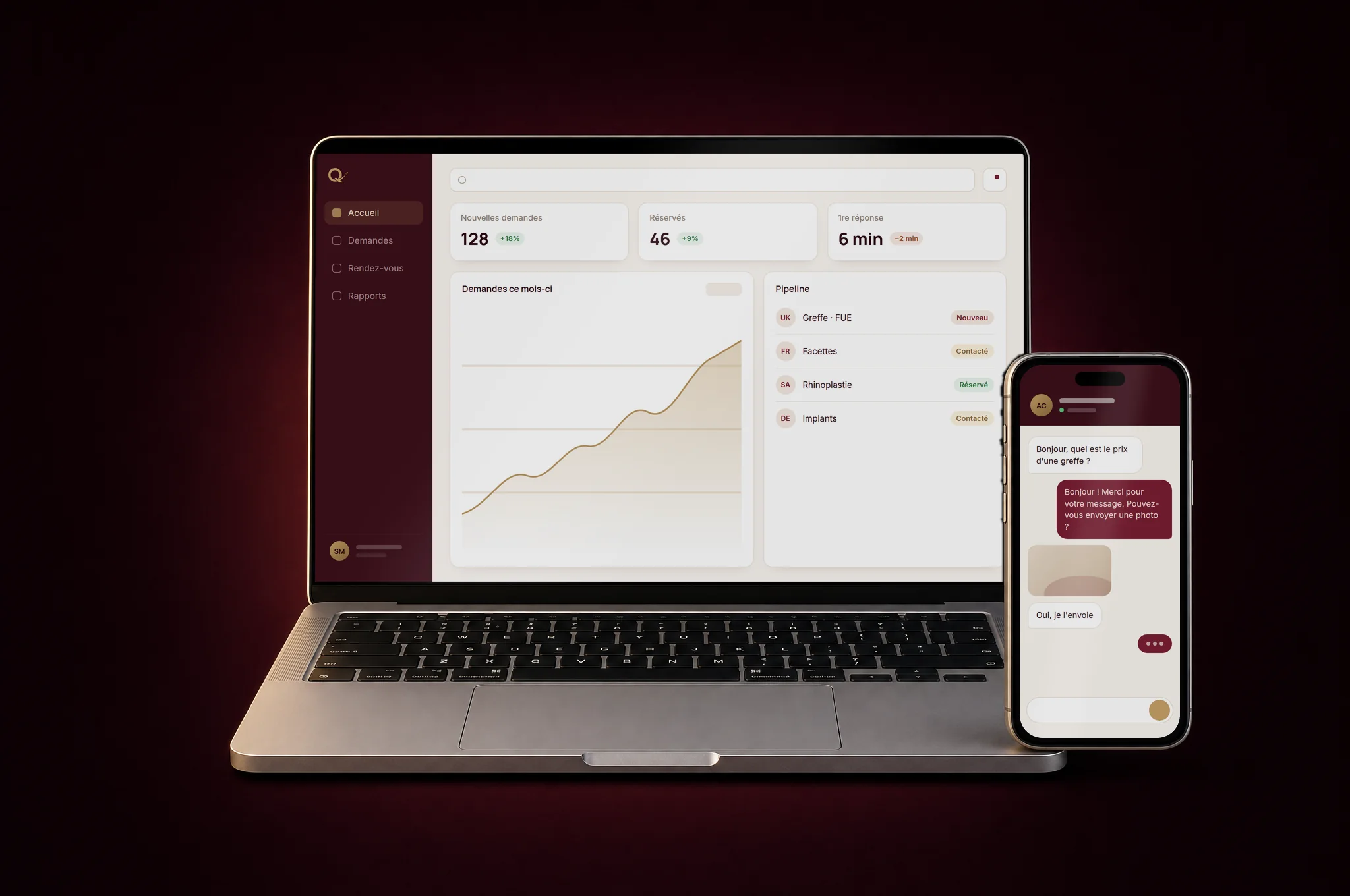 Exemple d'interface